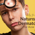 Naturopathic Dermatologist For Acne Treatment