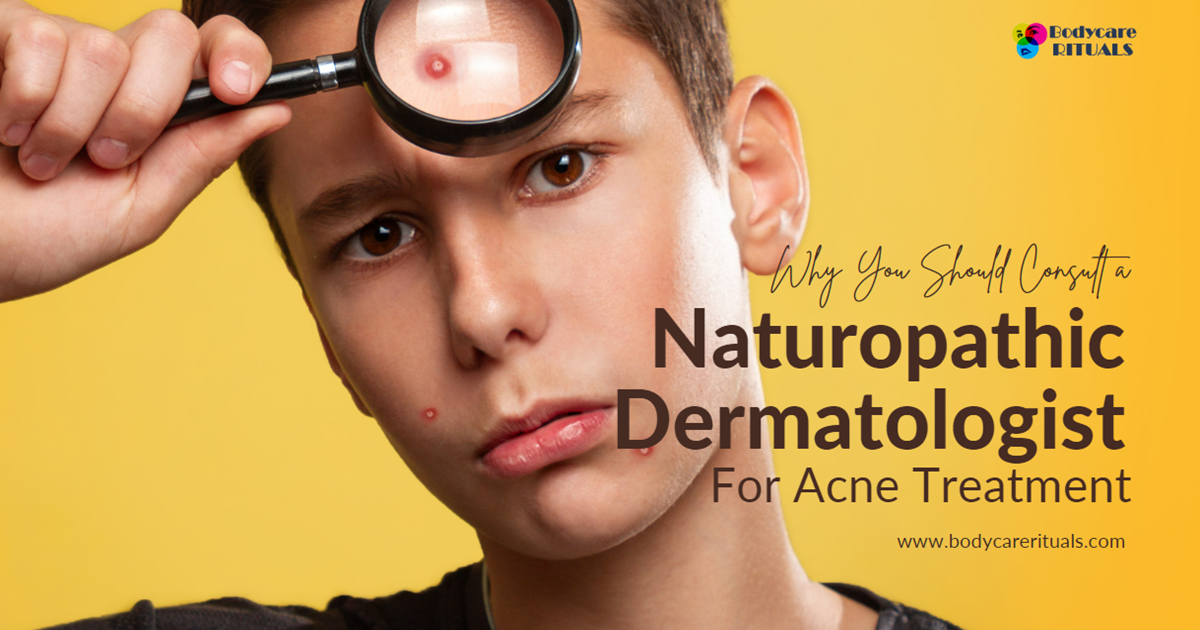 Naturopathic Dermatologist For Acne Treatment